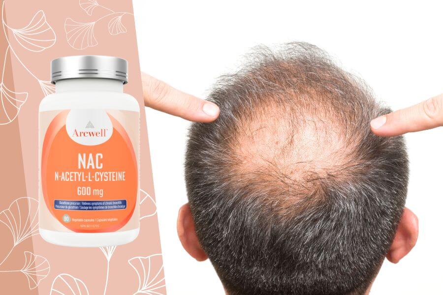 Are there any supplements that can help grow hair on Bald Patches Naturally?